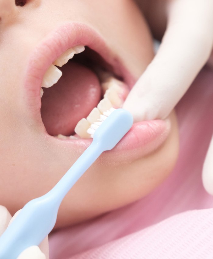 Профессиональная гигиена зубов