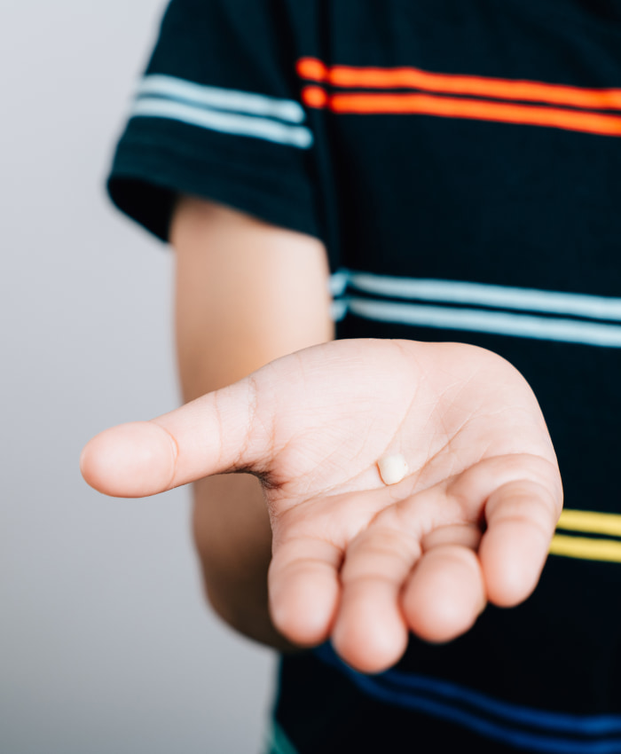 Удаление молочных зубов