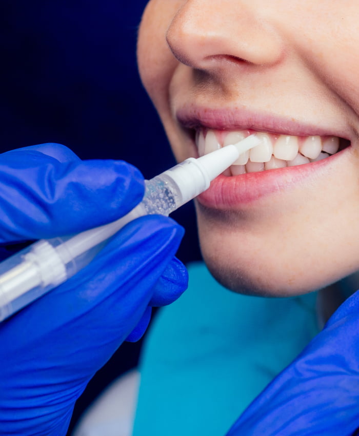 Коронки на молочные зубы